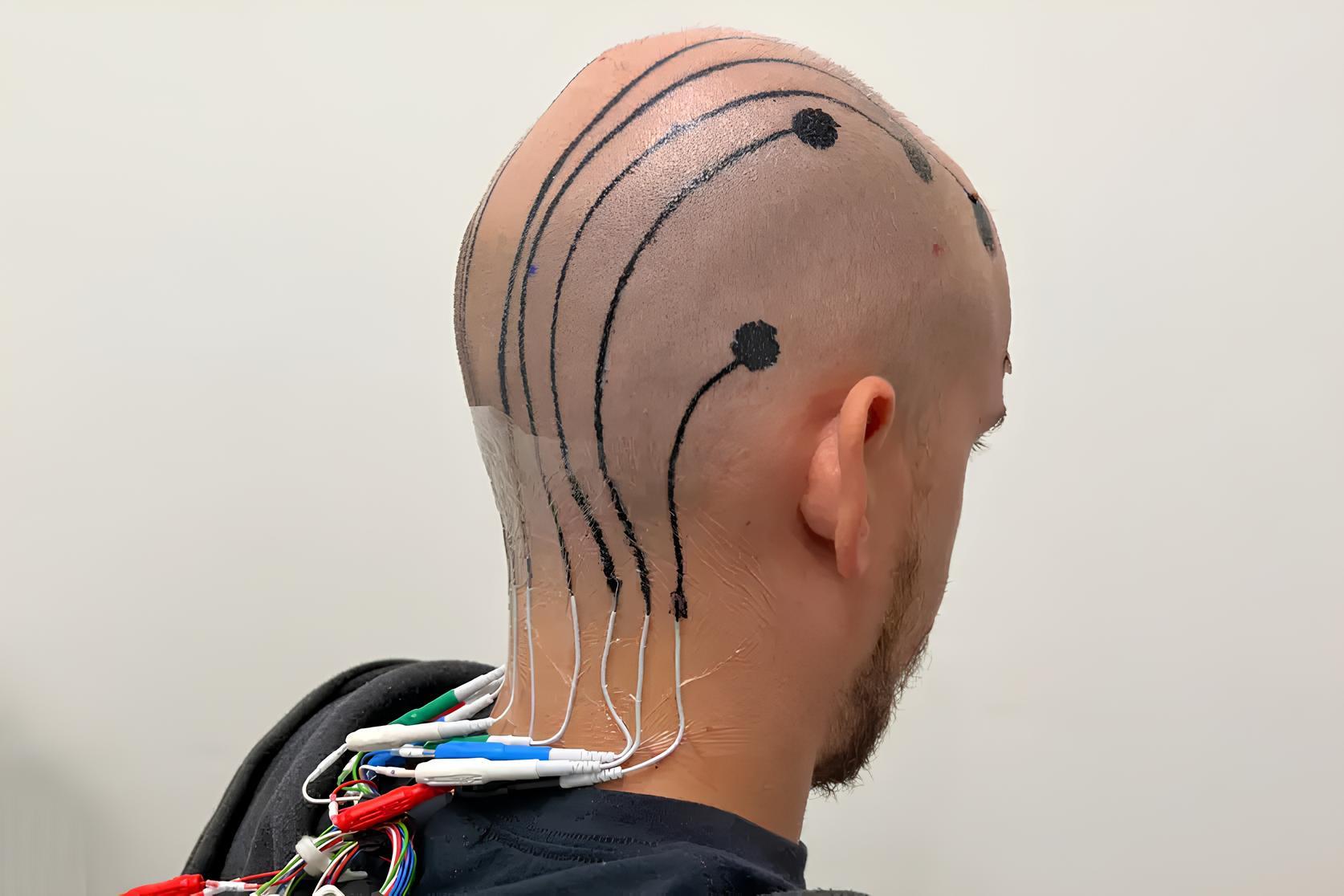 Hình xăm tạm thời thay thế điện cực trong kiểm tra sóng não - Techlade