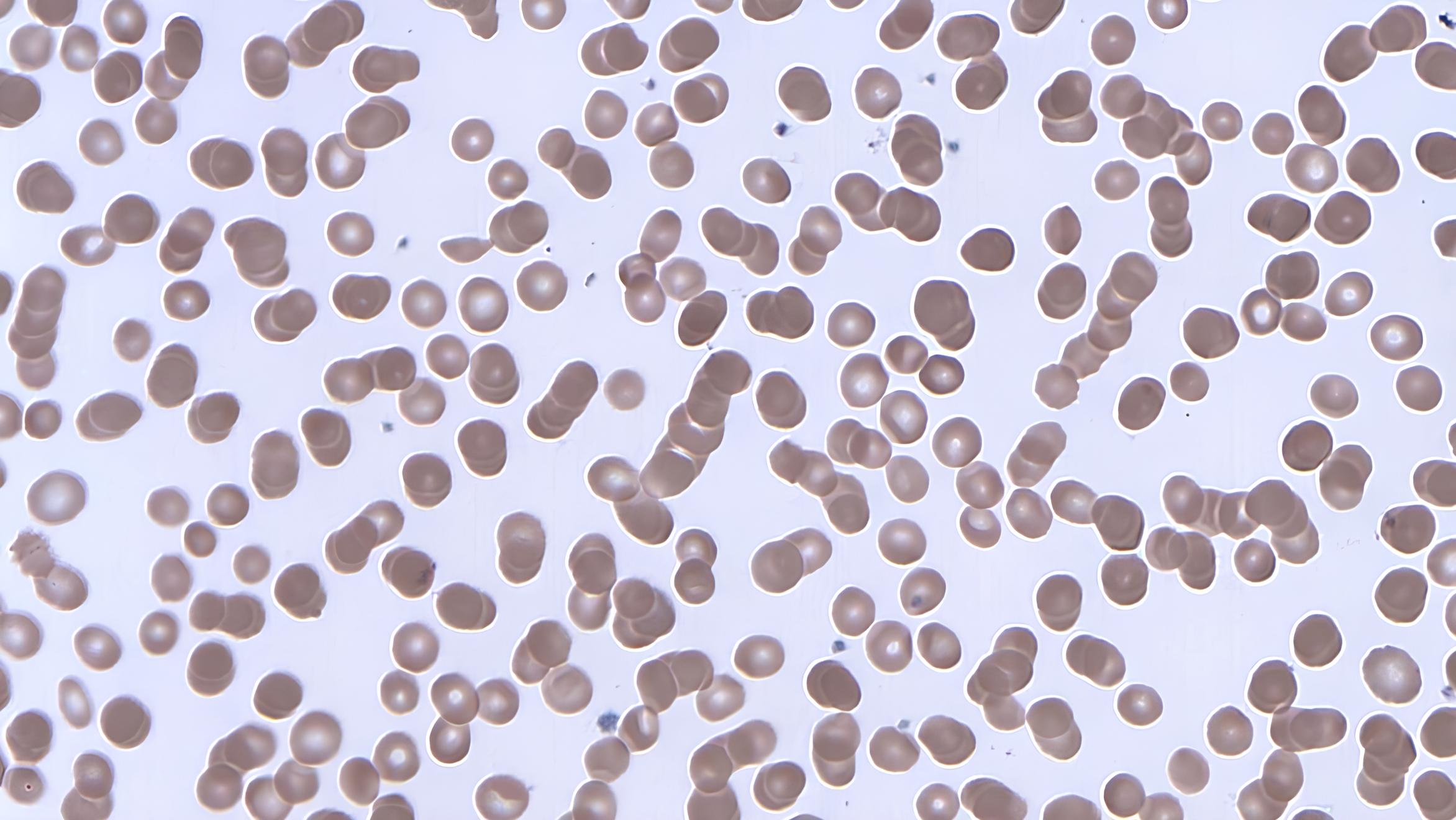 Smartphone có thể gây hại cho lưu thông máu? Nghiên cứu mới "gây tranh cãi" - Techlade