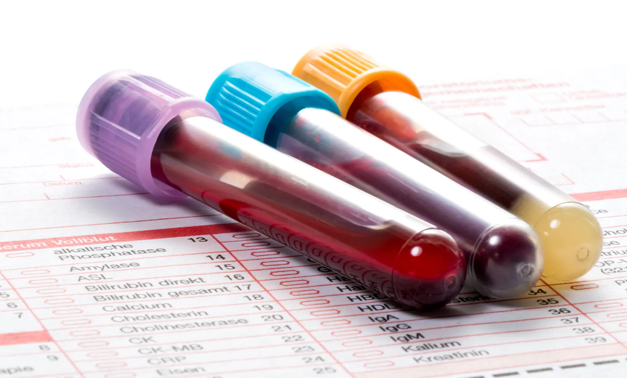 Xét nghiệm máu mới giúp phát hiện sớm ung thư tụy với độ chính xác cao - Techlade