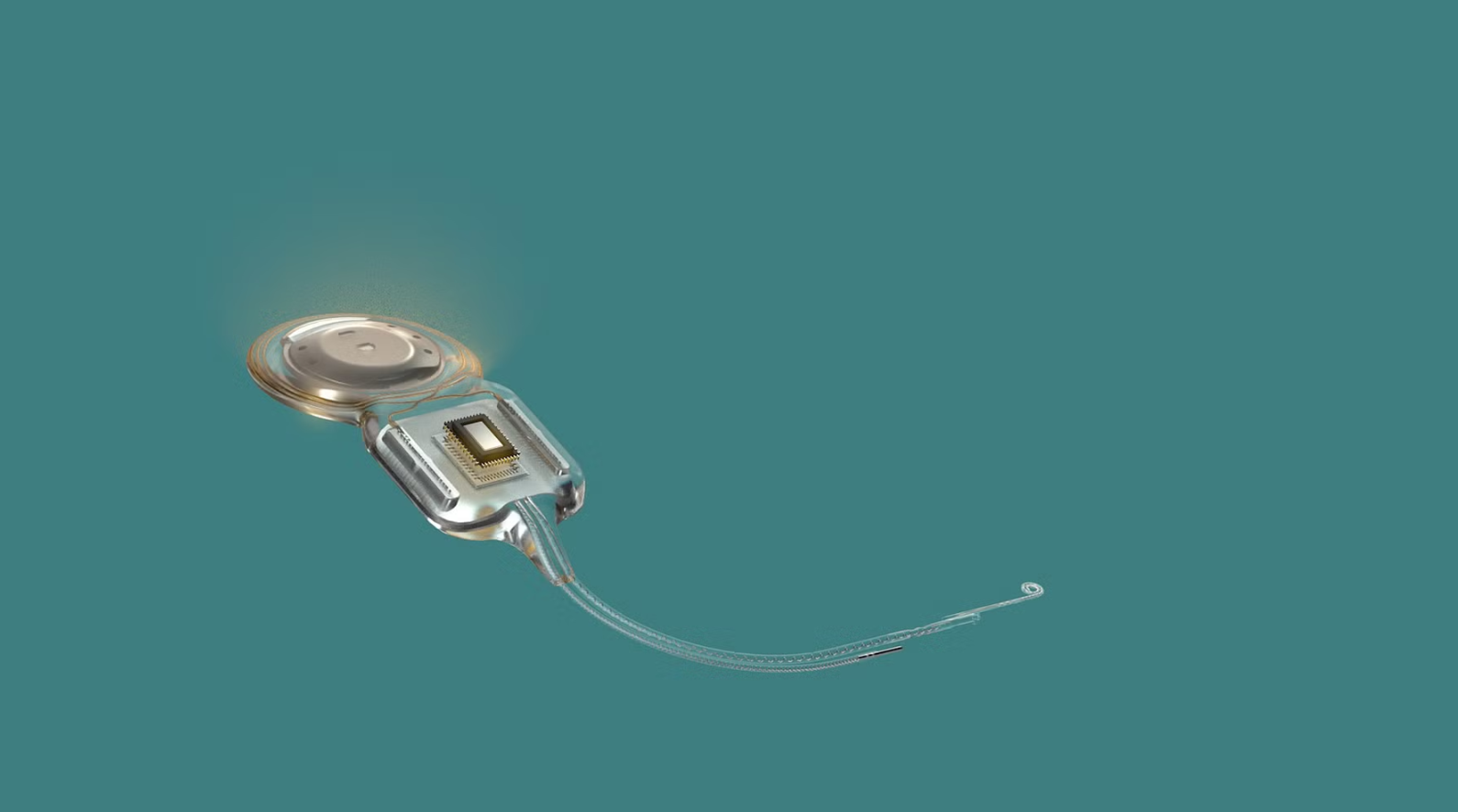 Cấy ghép Cochlear Nucleus Nexus ra mắt: Cải thiện thính giác với firmware cập nhật - Techlade